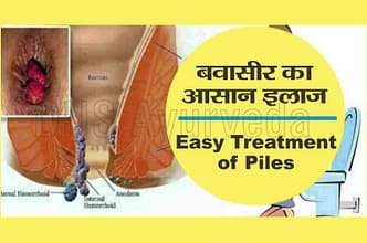 बवासीर या पाइल्स का आयुर्वेदिक इलाज | Ayurvedic treatment for piles in hindi