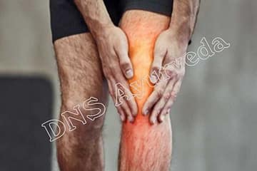 Arthritis Care and treatment