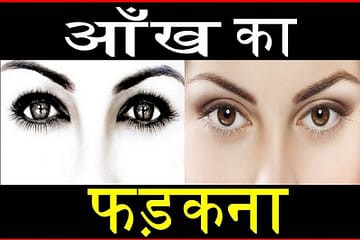 Reasons of Eye twitching, best ayurvedic clinic in lucknow