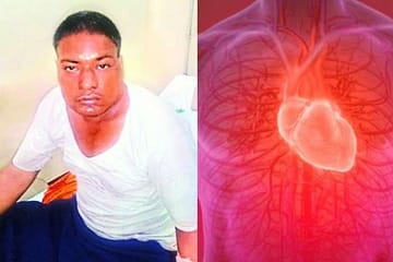 right sided heart man, dns ayurveda, health update, health news