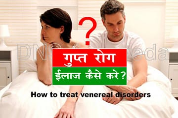 धातु रोग और गुप्त रोग का इलाज कैसे करें, How to treat venereal disorders