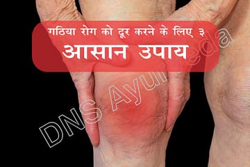 Gathiya treatment, गठिया रोग को दूर करने के लिए 3 आसान उपाय