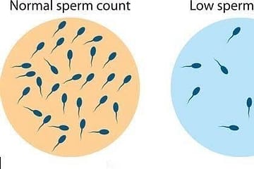 low sperm count, Oligospermia, Low Sperm Count , Infertility Treatment, Shukranu Ki Sankhya Kitni Honi Chahiye in Hindi
