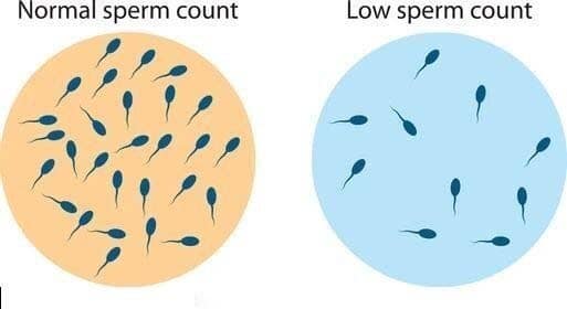 low sperm count, Oligospermia, Low Sperm Count , Infertility Treatment, Shukranu Ki Sankhya Kitni Honi Chahiye in Hindi