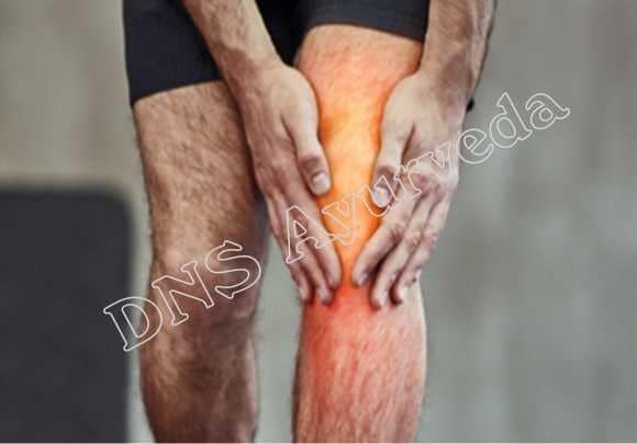 Arthritis Care and treatment