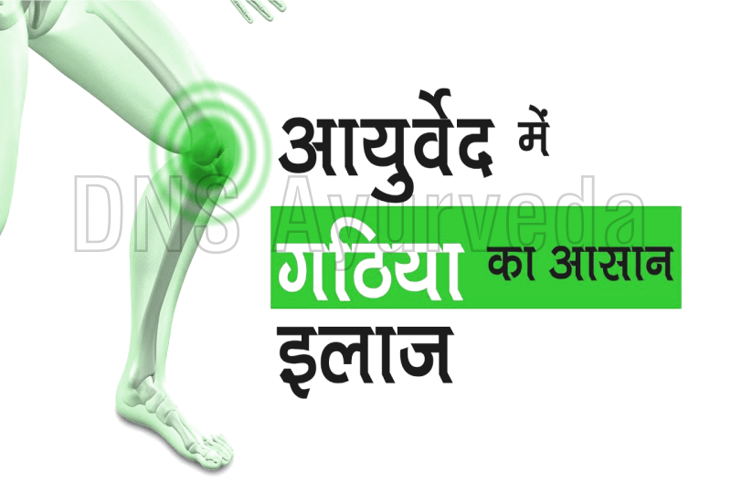 जानें गठिया का इलाज हिन्दी में, Gathiya ka ilaj in hindi