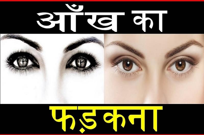 Reasons of┬аEye twitching, best ayurvedic clinic in lucknow