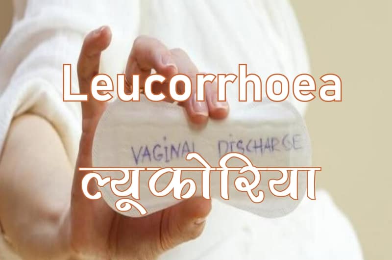 Leucorrhoea Medicine, ल्यूकोरिया की दवा