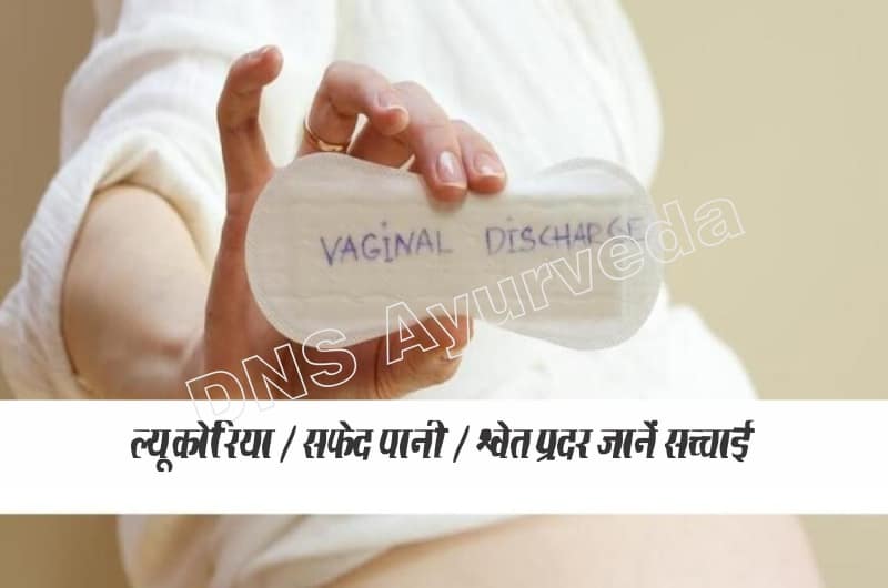 Leucorrhoea treatment in hindi, ल्यूकोरिया का इलाज इन हिन्दी