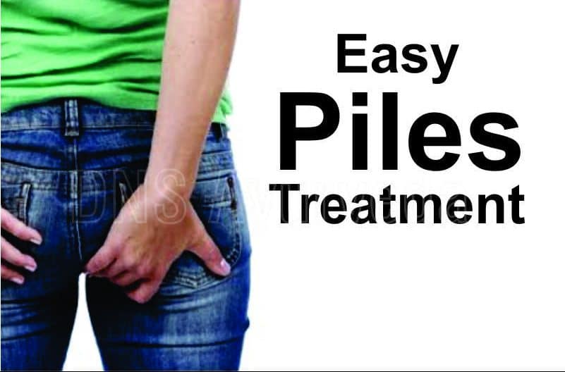 Bawaseer ka ilaj in hindi | बवासीर का इलाज हिन्दी में | Piles Treatment